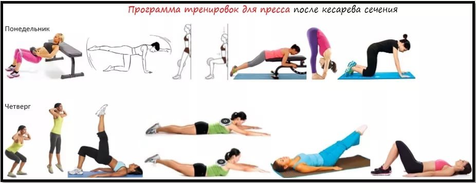 Коли після кесарева розтину і пологів можна дівчині, мамі, що годує качати прес? Вправи на прес після пологів та кесаревого розтину: опис, фото