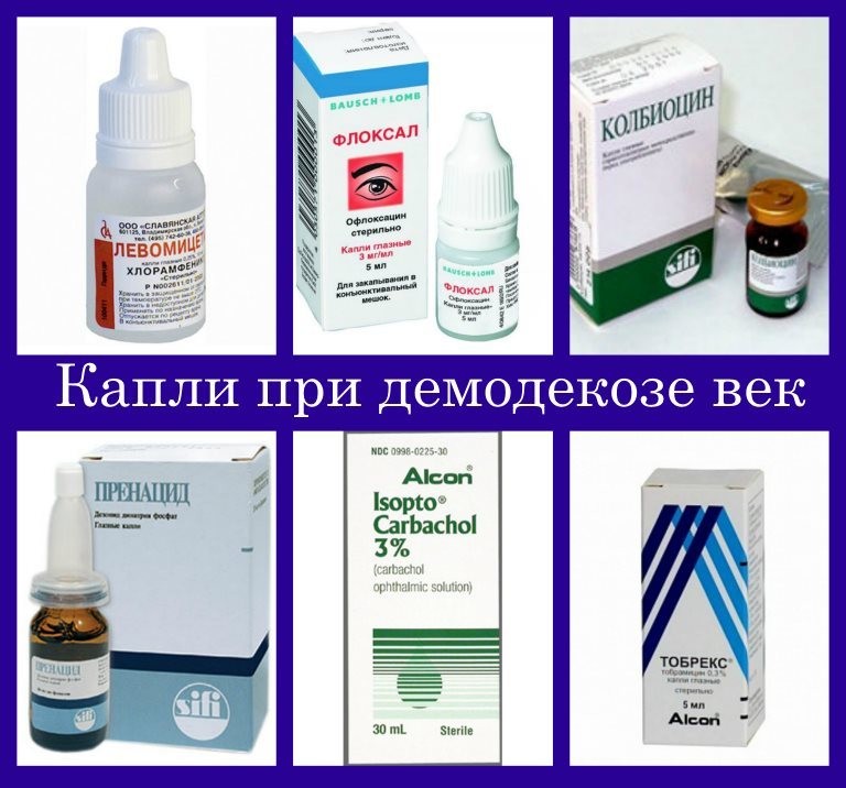 Що таке демодекоз і демодекс у людини: опис, фото. Хвороба у людини демодекоз: шляхи зараження, причини прищів, початкові ознаки, симптоми, діагностика, аналіз, лікування шкіри в домашніх умовах медикаментозне і народними засобами, профілакти