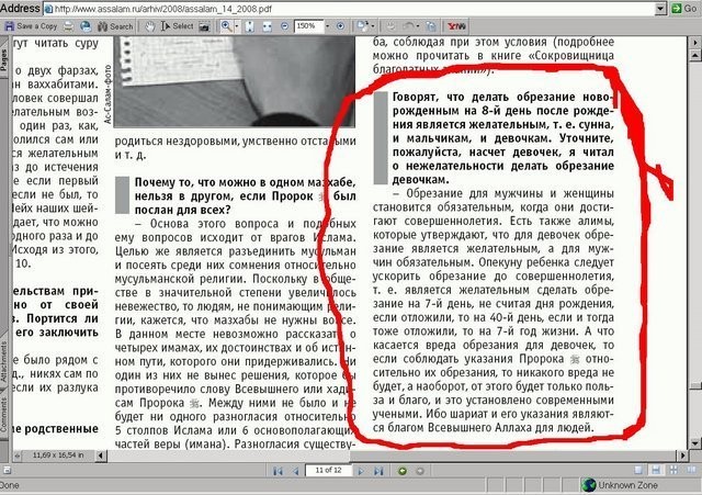 Обрізання крайньої плоті у чоловіків: причини і наслідки. Операція з обрізання у чоловіків: фото до і після