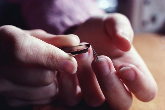 Заноза на пальці під нігтем: що робити, як дістати? Як з під нігтя витягнути скалку: стару металеву, від скла, кактуса, якщо вона глибоко?
