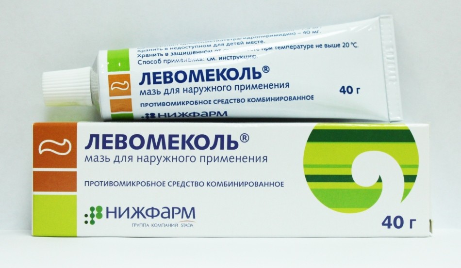 Що таке дике м'ясо біля нігтя на руці і нозі? Як лікувати дике м'ясо на нігтів народними засобами, чистотілом, лазером?