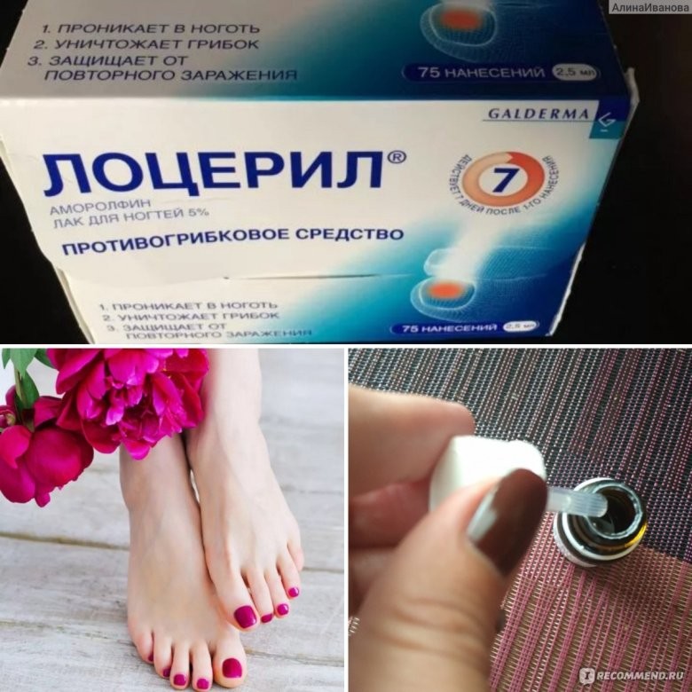 Капли для ногтей от грибка экзодерил