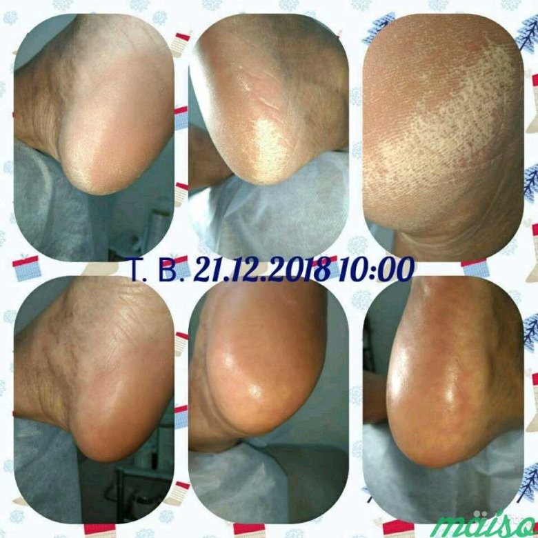 Golden Trace купить