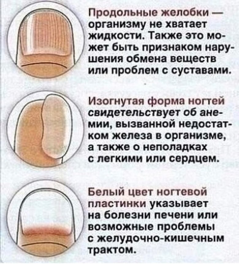 Белые пятна у основания ногтя