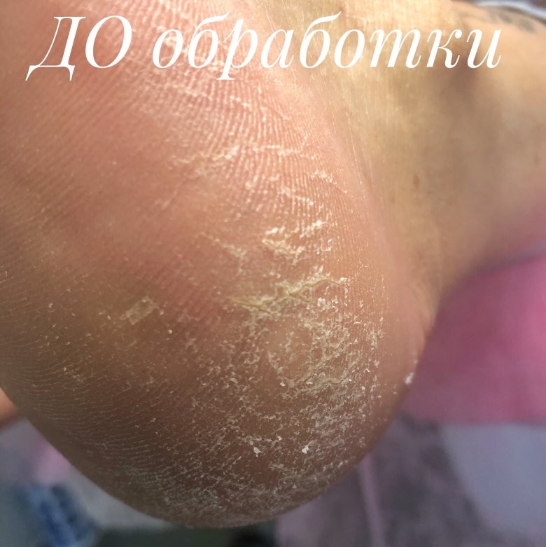 Педикюр Голден