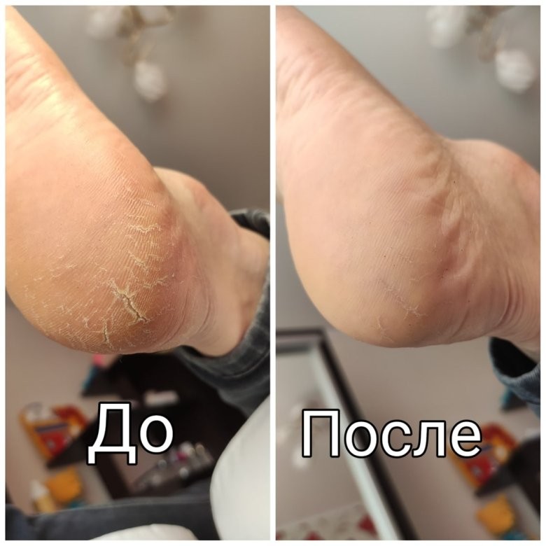 Педикюр Голден